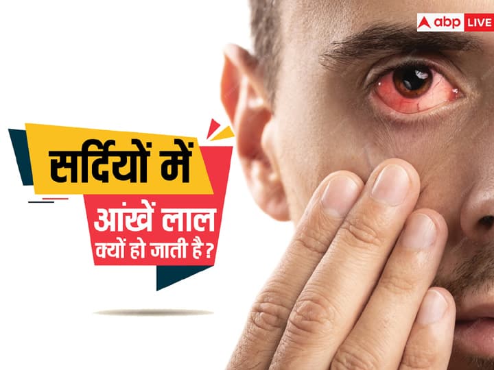 If your eyes become red in winter then know the solution from the expert you will get immediate relief सर्दियों में आंखें लाल हो जाती है तो एक्सपर्ट से जानें उपाय, तुरंत मिलेगा छुटकारा