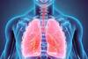 Health Tips : कौटुंबिक इतिहास हे फुफ्फुसाच्या कर्करोगाचं कारण असू शकतं; धूम्रपान न करणाऱ्यांनाही धोका