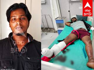 Puducherry rowdy who hurled a bomb at a businessman asking for money - TNN மாமூல் கேட்டு தொழிலதிபர் மீது வெடிகுண்டு வீசிய ரவுடி - புதுச்சேரியில் பரபரப்பு