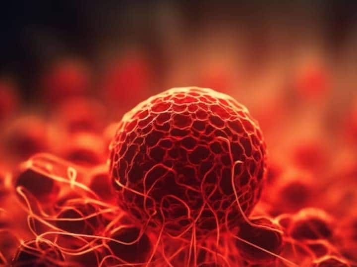 Tata Cancer Hospital teaches AI how to detect cancer from scans Why this is a key step forward AI की मदद से कैंसर जैसी खतरनाक बीमारी पता लगाया जा सकता है, TATA कैंसर हॉस्पिटल ने शुरू की यह खास सुविधा