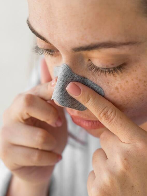 ब्लैकहेड्स निकालने का सबसे आसान तरीका