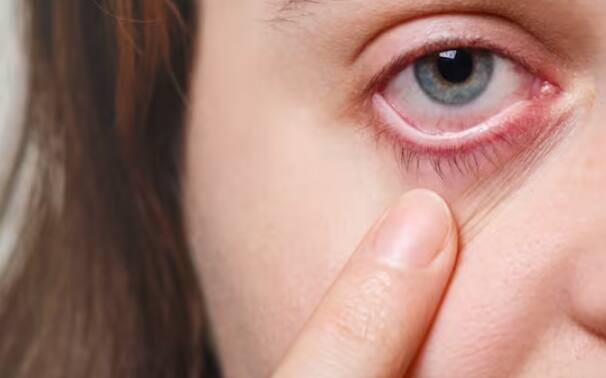 ਮਾਹਿਰਾਂ ਅਨੁਸਾਰ ਅੱਖਾਂ ਦੀ ਸਿਹਤ ਲਈ ਲੋੜੀਂਦੀ ਨੀਂਦ ਬਹੁਤ ਜ਼ਰੂਰੀ ਹੈ। ਵਿਅਕਤੀ ਨੂੰ ਹਰ ਰਾਤ 7-8 ਘੰਟੇ ਦੀ ਡੂੰਘੀ ਨੀਂਦ ਲੈਣੀ ਚਾਹੀਦੀ ਹੈ ਤਾਂ ਜੋ ਅੱਖਾਂ ਨੂੰ ਅਰਾਮ ਮਿਲ ਸਕੇ ਅਤੇ ਟਿਸ਼ੂਆਂ ਨੂੰ ਠੀਕ ਕਰਨ ਦਾ ਮੌਕਾ ਮਿਲ ਸਕੇ।