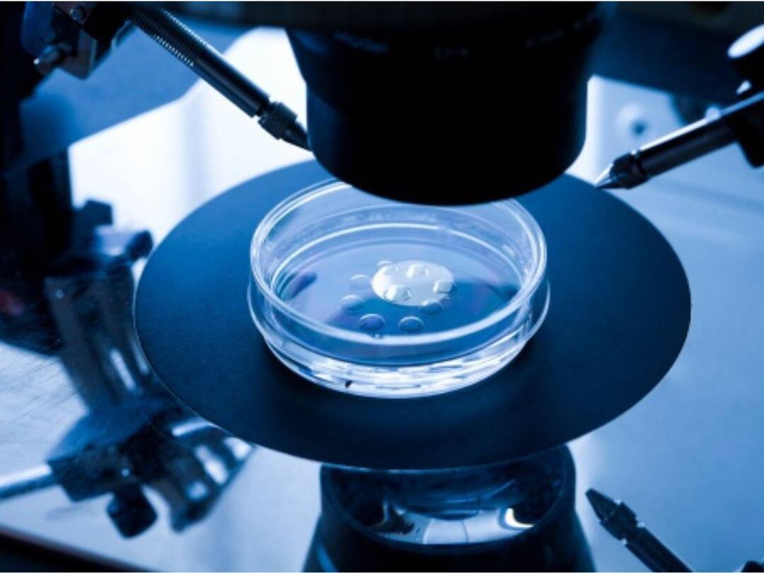 What Is IVF? Know What Role It Plays In Raising Fertility Chances For Women Above 40 IVF Know What Role It Plays In Raising Fertility Chances For Women Above 40 What Is IVF? Know What Role It Plays In Raising Fertility Chances For Women Above 40