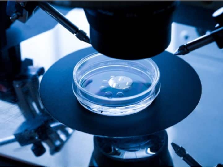 IVF Know What Role It Plays In Raising Fertility Chances For Women Above 40 What Is IVF? Know What Role It Plays In Raising Fertility Chances For Women Above 40