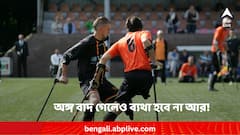 অঙ্গ বাদ গেলেও ব্যথা হবে না আর ! বিশেষ কায়দার চিকিৎসার খোঁজ দিল গবেষণা