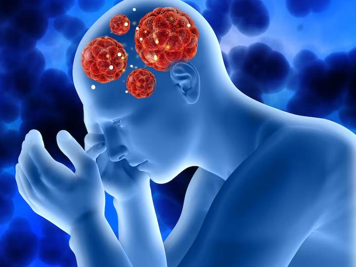 Brain Tumour: ये हैं वो कारण, जिनकी वजह से हो सकता है ब्रेन ट्यूमर, जानें
