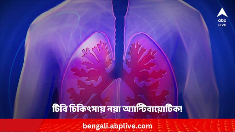 Scientists found new antibiotic for tuberculosis treatment Tuberculosis: টিবি চিকিৎসায় নয়া অ্যান্টিবায়োটিকের খোঁজ পেলেন বিজ্ঞানীরা ! কীভাবে কাজ করে এটি