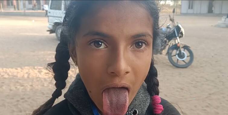 Banaskantha Controversy News: Dhanera School Students Tongue change into black colour after the taking the Mid Day Meal Banaskantha: મધ્યાહન ભોજનની આડઅસર, બાળકોએ બપોરે ખીચડી ખાધી તો જીભ કાળી પડી ગઇ, તપાસના આદેશ