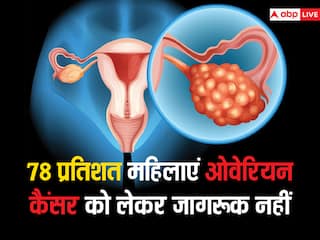 78 प्रतिशत महिलाएं आज भी ओवेरियन कैंसर के लक्षण से हैं अनजान, यहां जानें क्या करें और क्या नहीं?