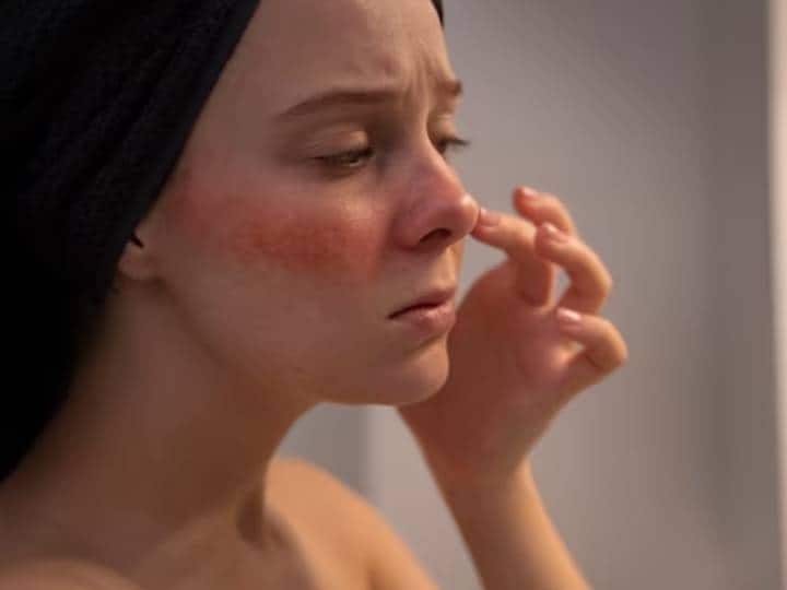 सर्दियों में स्किन से जुड़ी कई सारी परेशानी का सामना करना पड़ता है. आपने अगर ध्यान दिया होगा तो सर्दियों में हमारा स्किन नेचुरल तरीके से काफी ज्यादा ड्राई हो जाता है. ऐसे इसलिए भी होता है क्योंकि ठंडी हवाओं के कारण त्वचा का पानी सुखने लगता है. यही वजह है कि नहाने के बाद स्किन ड्राई, खुजली और इरिटेशन होने लगता है. वहीं कुछ लोगों के साथ यह समस्या काफी ज्यादा बढ़ जाती है. हालांकि सही तरीके से मॉइस्चराइज न करना भी इसका मुख्य कारण हो सकता है. आइए इस आर्टिकल के जरिए इसके पीछे के सभी कारणों के बारे में जानें.