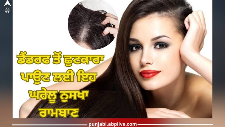 Dandruff problem: This home remedy to get rid of dandruff, know how to make it Dandruff problem: ਡੈਂਡਰਫ ਤੋਂ ਛੁਟਕਾਰਾ ਪਾਉਣ ਲਈ ਇਹ ਘਰੇਲੂ ਨੁਸਖਾ ਰਾਮਬਾਣ, ਜਾਣੋ ਇਸ ਨੂੰ ਬਣਾਉਣ ਦਾ ਤਰੀਕਾ