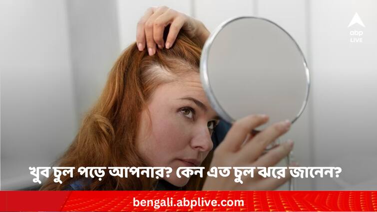 Hair fall these are the major four reasons Hair fall: খুব চুল পড়ে আপনার ? কেন এত চুল ঝরে জানলেই খুঁজে পাবেন সমাধানের পথ