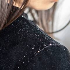 Hair Care: ਸਰਦੀਆਂ ਚ ਕੀ ਤੁਹਾਡੇ ਵੀ ਹੁੰਦੀ ਹੈ ਵਾਰ ਵਾਰ ਸਿੱਕਰੀ?