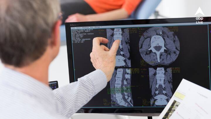 হাড়ের স্বাস্থ্য: হাড়ের স্বাস্থ্য ভাল রাখতে সাহায্য করে এই বিশেষ সবজিটি‌।‌ শীতকালের সবজি সিমের মধ্যে ভিটামিন ডি ও ফসফরাস প্রচুর পরিমাণে রয়েছে। এই দুই উপাদান হাড়ের যত্ন নেয়। (প্রতীকী ছবি সৌজন্য: পিক্স্যাবে)