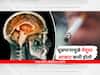 Smoking : धूम्रपानामुळे मेंदूचा आकार कमी होतो, स्मरणशक्तीवरही परिणाम; वेळीच वाईट सवय सोडा
