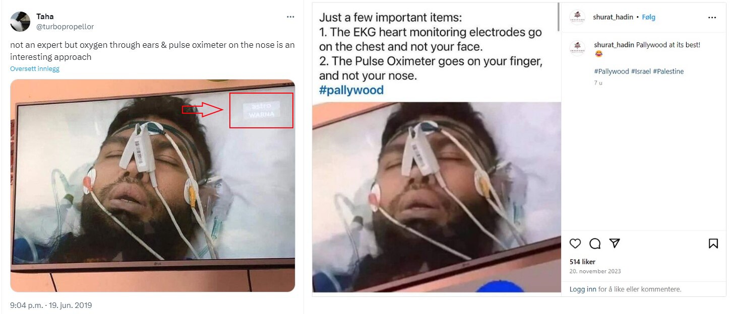 Fact Check: Old Photo Of Man In Hospital Bed Shared As Gaza 'Crisis Actor