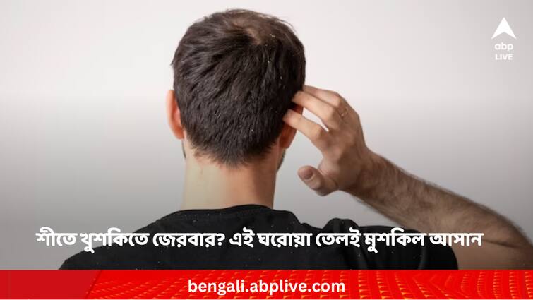 Neem oil can reduce the dandruff issues in winter Dandruff Remedies: শীতের মরসুমে খুশকিতে জেরবার? এই ঘরোয়া তেল জানে মুশকিল আসান