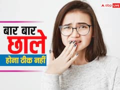 क्या आपको भी हो जाते हैं बार-बार छाले? तो हल्के में न लें, हो सकती हैं ये पांच गंभीर बीमारियां
