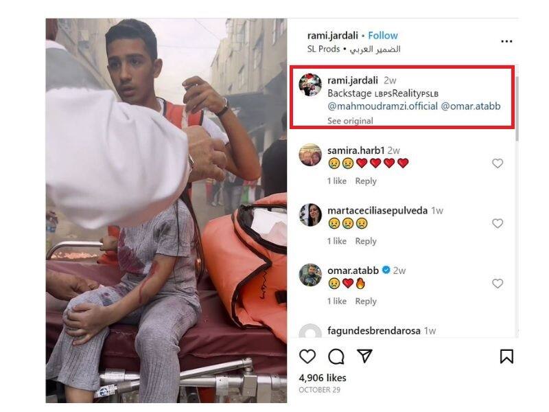 मेकअप से फर्जी चोट बनाकर दुनिया को मूर्ख बना रहे फिलिस्तीनी? जानें क्या है इस वायरल दावे की सच्चाई