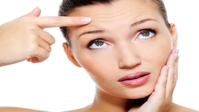 Not just Botox injections but these simple home remedies can also get rid of fine lines Beauty tips:બોટોક્સ ઇંજેકશન જ નહિ પરંતુ આ સરળ ઘરેલુ ઉપચારથી પણ દૂર કરી શકો છો  ફાઇન લાઇન્સ