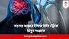 Stroke Symptoms:ইমেজিংয়ে ধরা পড়ে না, লক্ষণও বুঝে ওঠার আগেই গায়েব ! কী করে চিনবেন বড় স্ট্রোকের আগাম সঙ্কেত TIA-কে?