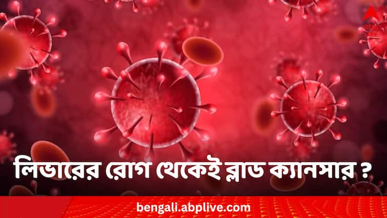 Hepatitis B And C can Cause Multiple Myeloma Cancer Blood Cancer reason:রক্তের কঠিন ক্যানসার আটকে দিতে পারে একটি ছোট্ট ওষুধ ! চাঞ্চল্যকর দাবি গবেষণায়