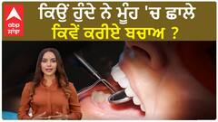 Mouth ulcers reason |ਕਿਉਂ ਹੁੰਦੇ ਨੇ ਮੂੰਹ 'ਚ ਛਾਲੇ , ਕਿਵੇਂ ਕਰੀਏ ਬਚਾਅ ?