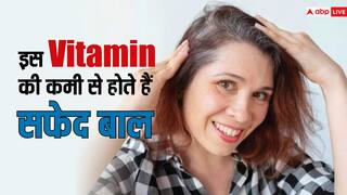 क्या उम्र से पहले ही सफेद हो रहे हैं आपके बाल, तो हो सकती है इस विटामिन की कमी, इस तरह करें पूरी