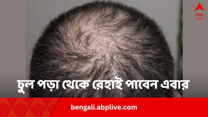 Curry Leaves for Hair: চুল পড়ছে বলে চিন্তায় চিন্তায় ঘুম উড়ে যাচ্ছে? চুলের দশরকম ঝামেলা থেকে রেহাই দেবে এই একটি পাতাই।