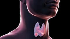 Salivary Gland Cancers, Small Intestine Adenocarcinoma – Rare Cancers In India And Strategies To Prevent Them