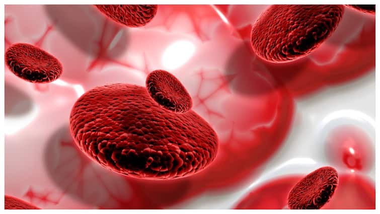 Hemoglobin has reduced in winter so know what to eat सर्दियों में कम हो गया है हीमोग्लोबिन तो जानें क्या खाएं, नस-नस में दौड़ने लगे खून
