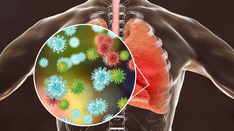 Pakistan Pneumonia Outbreak Kills 200 Children As Severe Cold Grips Punjab Province Pakistan: Pneumonia Outbreak Kills 200 Children As Severe Cold Grips Punjab Province