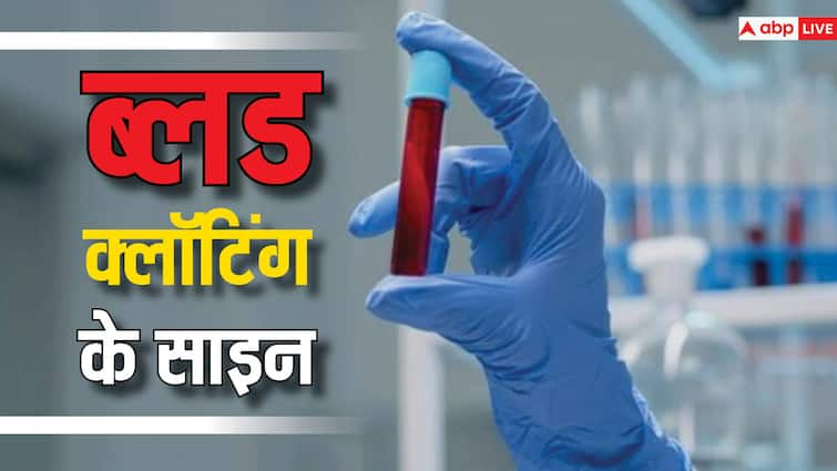 health tips blood clot in winter know reason symptoms and treatment in hindi सर्दियों में क्यों बढ़ जाता है ब्लड क्लॉट का खतरा, जानें कारण और इलाज