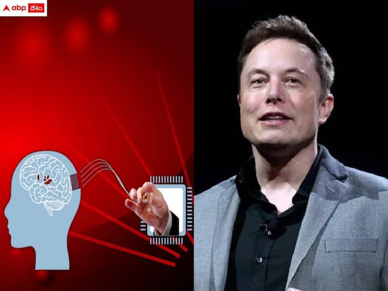 elon musks neuralink implants wireless brain chip in human for 1st time details in telugu Elon Musk: మానవ మెదడులో 'చిప్' - తొలి ప్రయోగం సక్సెస్ అంటూ ఎలాన్ మస్క్ కీలక ప్రకటన