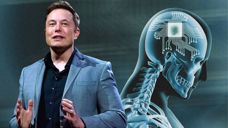 Elon Musk Neuralink implants brain chip in first human brain implant in its first human patient marathi news काय सांगता! मानवाच्या मेंदूमध्ये चिप, विचार करण्यावरही गॅजेट कंट्रोल, एलॉन मस्क यांच्या कंपनीचा अविष्कार