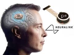 Elon Musk Announces Neuralink Human Trails : సక్సెస్ దిశగా న్యూరాలింక్ తొలి ప్రయోగం | ABP Desam