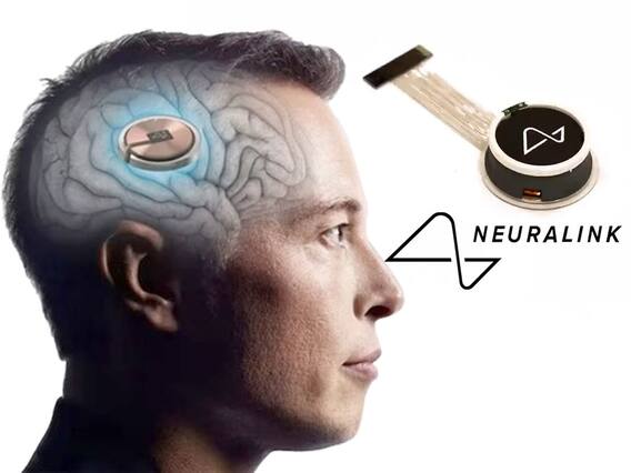 Elon Musk Announces Neuralink Human Trails : సక్సెస్ దిశగా న్యూరాలింక్ తొలి ప్రయోగం | ABP Desam