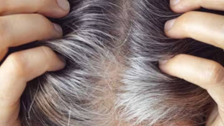 કહેવાય છે કે,દરેક વસ્તુ માટે યોગ્ય સમય હોય છે. જો નાની ઉંમરમાં વાળ સફેદ થવા લાગે તો તે વસ્તુ હંમેશા ખૂંચ્યા કરે છે અને સૌદર્યમાં બાધક બને છે.