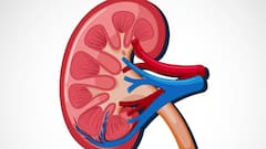 Health Tiips: किडनी स्टोन से जुड़े ऐसे मिथ जिसे हम अक्सर समझ लेते हैं सच