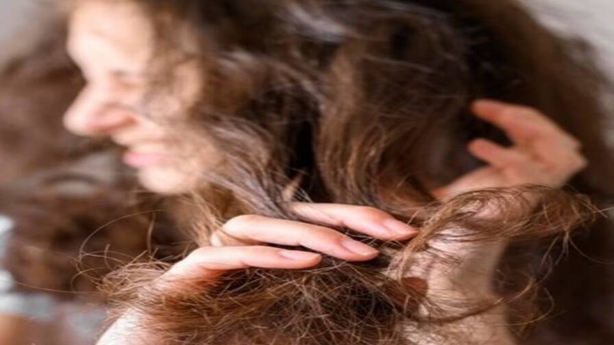 Hair Fall Problem:8 Tips To Protect Your Hair During Winter Hair Fall Problem: શું તમે નાની ઉંમરમાં વાળ ખરવાની સમસ્યાથી પરેશાન છો? આજે જ અપનાવો આ ટિપ્સ