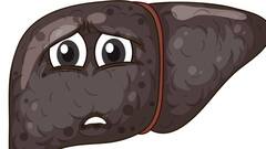 फैटी लिवर या सूजन के यह होते हैं शुरुआती लक्षण, समय रहते पहचान कर... ऐसे करें बचाव