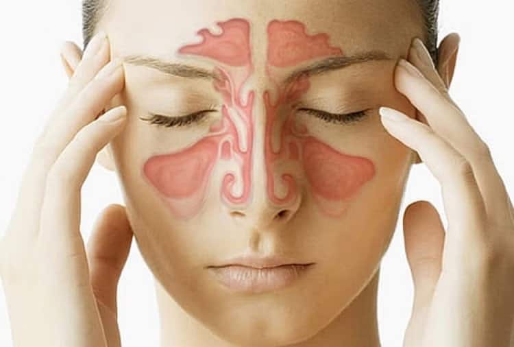 Are you suffering from sinus problems So to get rid of it, adopt these 5 panacea remedies Health:સાયનસની સમસ્યાથી પરેશાન છો? તો છુટકારો મેળવવા માટે આ 5 રામબાણ ઇલાજ અપવાનો