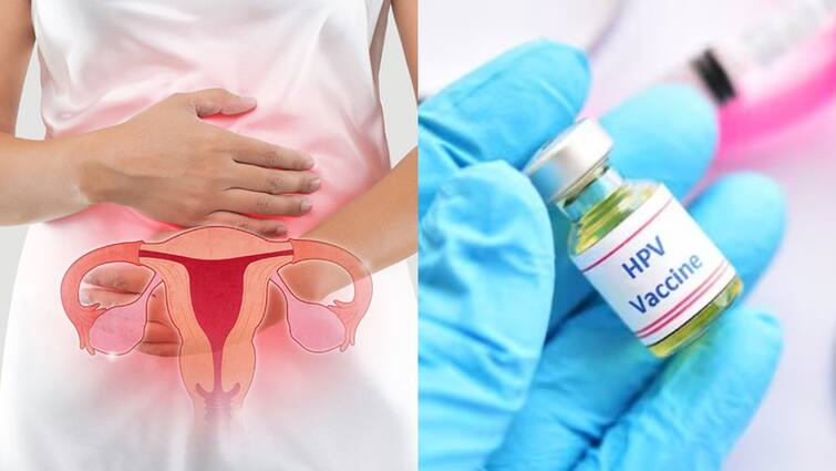 Cervical cancer Cervavac HPV vaccines available cost and age groups details here Cervical cancer: பெண்களே அவசியம் தெரிஞ்சுக்கோங்க! கர்பப்பை வாய் புற்றுநோய் தடுப்பூசியின் விலை இதுதான்!