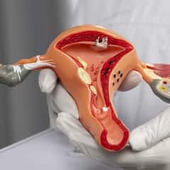 Cervical Cancer: ਕੀ ਹੈ ਸਰਵੀਕਲ ਕੈਂਸਰ ਜੋ ਹਰ ਦਿਨ ਲੈਂਦਾ 211 ਔਰਤਾਂ ਦੀ ਜਾਨ ? ਜਾਣੋ ਲੱਛਣ ਤੇ ਬਚਾਅ