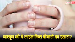 नाखून पर नजर आने लगें ऐसे रंग तो हो जाएं सावधान, इस बीमारी की ओर करते हैं इशारा