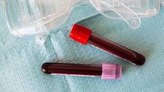 Hemoglobin Level :शरीरातील हिमोग्लोबिनचे प्रमाण वाढेल ' हे ' पदार्थ आजपासून बनवा आपल्या आहाराचा भाग !