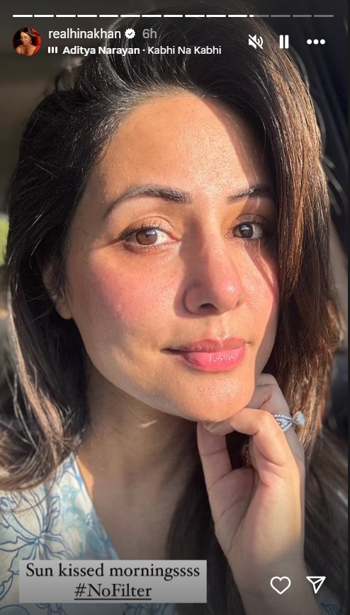 How does Hina Khan look without a filter?  Showed real face with sun kissed photo