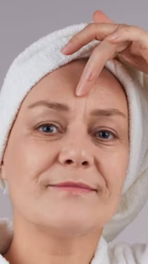 কপালের বলিরেখা দূর হতে পারে সহজেই