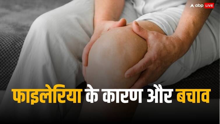 Uttar Pradesh Government Urges Public To Take Preventative Medication Against Lymphatic Filariasis किस वजह से होता है फाइलेरिया, बीमारी की रोकथाम के लिए 17 जिलों में शुरू होने जा रहा अभियान