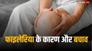 किस वजह से होता है फाइलेरिया, बीमारी की रोकथाम के लिए 17 जिलों में शुरू होने जा रहा अभियान